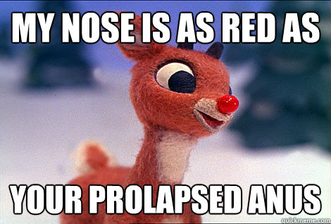 MY NOSE IS AS RED AS YOUR PROLAPSED ANUS  Condescending Rudolph