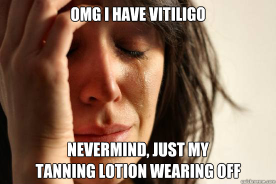 omg i have vitiligo Nevermind, just my
tanning lotion wearing off  First World Problems