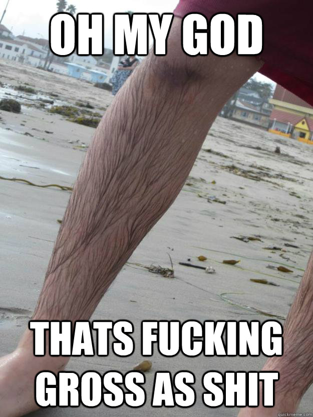 OH MY GOD thats fucking gross as shit - OH MY GOD thats fucking gross as shit  FLAMEASSTARDFAGGOT