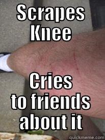 SCRAPES KNEE CRIES TO FRIENDS ABOUT IT Misc