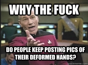 WHY THE FUCK Do people keep posting pics of their deformed hands?  Annoyed Picard