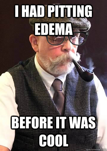 I had pitting edema before it was cool  Old man Hipster