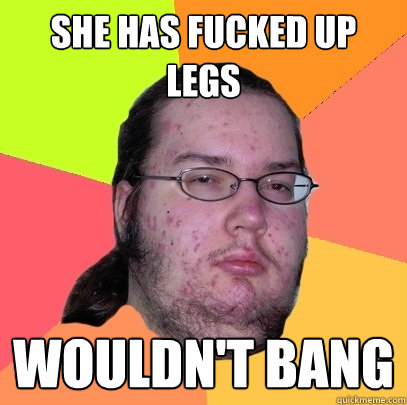 she has fucked up legs wouldn't bang  Butthurt Dweller