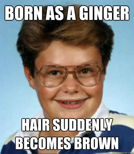 born as a ginger hair suddenly becomes brown  Lucky Larry