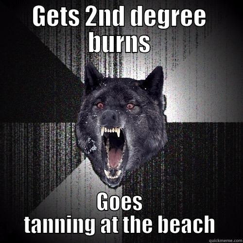GETS 2ND DEGREE BURNS GOES TANNING AT THE BEACH Insanity Wolf