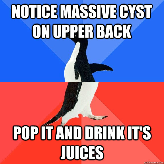Notice massive cyst on upper back Pop it and drink it's juices  Socially Awkward Awesome Penguin
