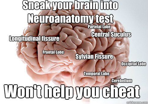 Longitudinal fissure Central Suculus Sylvian Fissure Sneak your brain into Neuroanatomy test Won't help you cheat  Cerebellum Frontal Lobe Occipital Lobe Temporal Lobe Parietal Lobe  Scumbag Brain