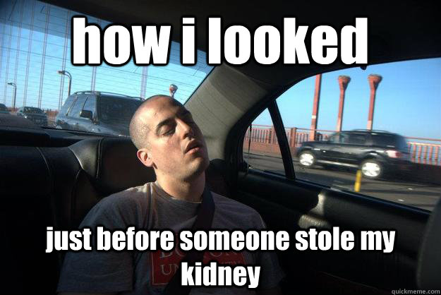how i looked just before someone stole my kidney  