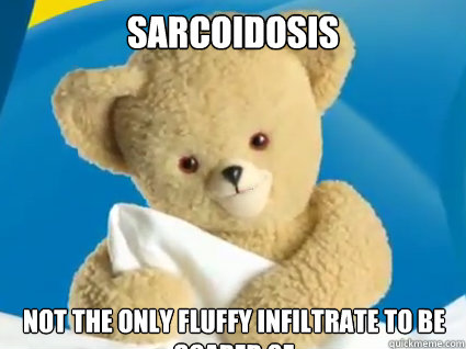 Sarcoidosis Not the only fluffy infiltrate to be scared of  