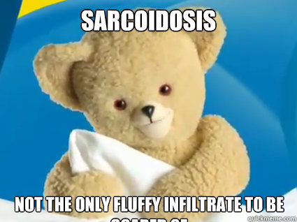 Sarcoidosis Not the only fluffy infiltrate to be scared of - Sarcoidosis Not the only fluffy infiltrate to be scared of  Creepy Snuggle Bear