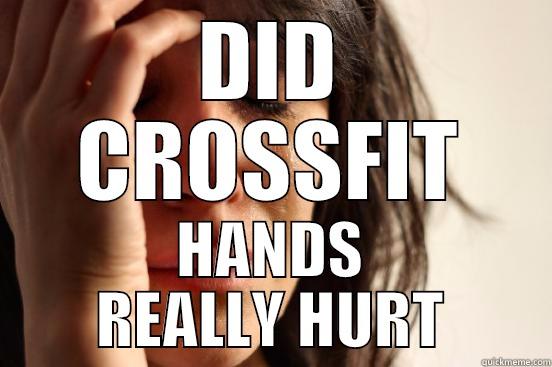 DID CROSSFIT HANDS REALLY HURT First World Problems