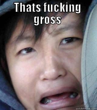 THATS FUCKING GROSS  Misc