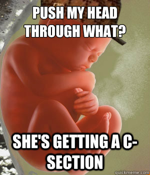 push my head through what? she's getting a c-section  