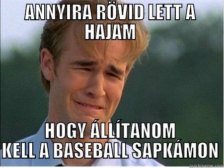 ANNYIRA RÖVID LETT A HAJAM HOGY ÁLLÍTANOM KELL A BASEBALL SAPKÁMON 1990s Problems