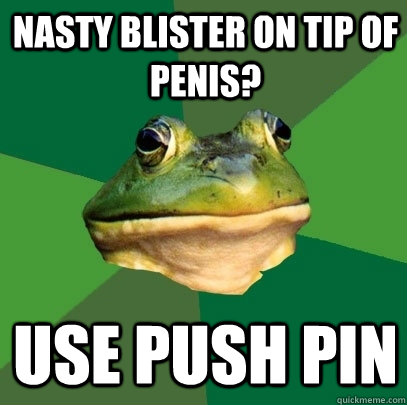 Nasty blister on tip of penis? use push pin  Foul Bachelor Frog