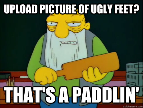 Upload picture of ugly feet? That's a paddlin'  Thats a paddling