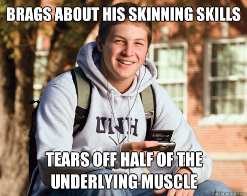 brags about his skinning skills tears off half of the underlying muscle  College Freshman