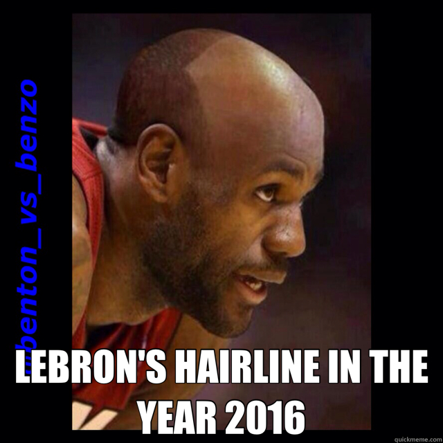  LEBRON'S HAIRLINE IN THE YEAR 2016 -  LEBRON'S HAIRLINE IN THE YEAR 2016  hairline