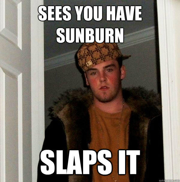 Sees you have sunburn slaps it - Sees you have sunburn slaps it  Scumbag Steve