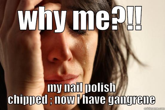 WHY ME?!! MY NAIL POLISH CHIPPED ; NOW I HAVE GANGRENE First World Problems