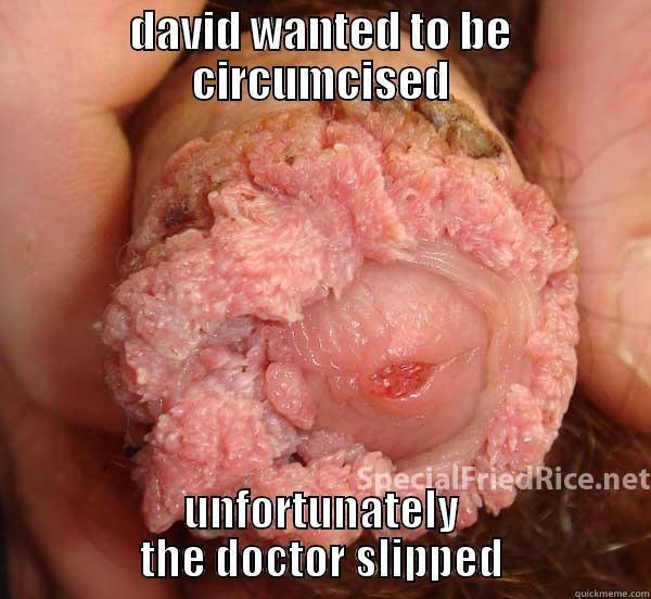 DAVID WANTED TO BE CIRCUMCISED UNFORTUNATELY THE DOCTOR SLIPPED Misc