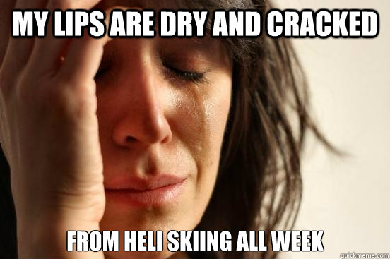 My lips are dry and cracked from heli skiing all week - My lips are dry and cracked from heli skiing all week  First World Problems