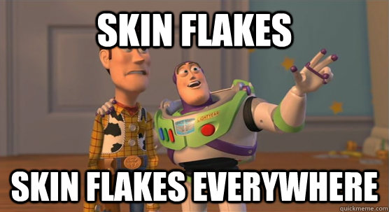 skin flakes skin flakes everywhere  Toy Story Everywhere