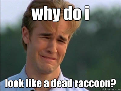 why do i  look like a dead raccoon?  Poor dawson