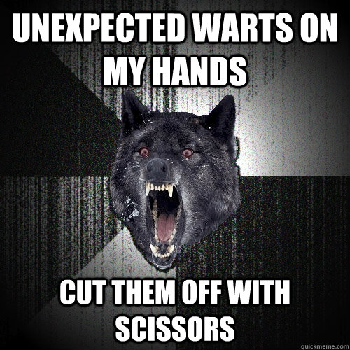 Unexpected warts on my hands cut them off with scissors  Insanity Wolf