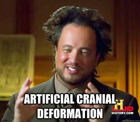  Artificial Cranial Deformation  Ancient Aliens