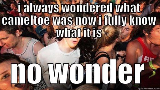 I ALWAYS WONDERED WHAT CAMELTOE WAS NOW I FULLY KNOW WHAT IT IS NO WONDER Sudden Clarity Clarence