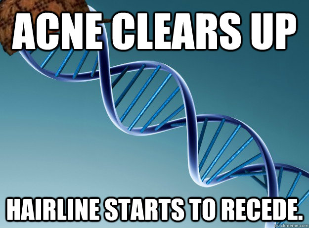 Acne clears up Hairline starts to recede. - Acne clears up Hairline starts to recede.  Scumbag Genetics