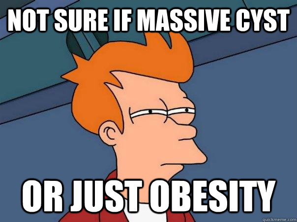 Not sure if massive cyst  Or just obesity - Not sure if massive cyst  Or just obesity  Futurama Fry