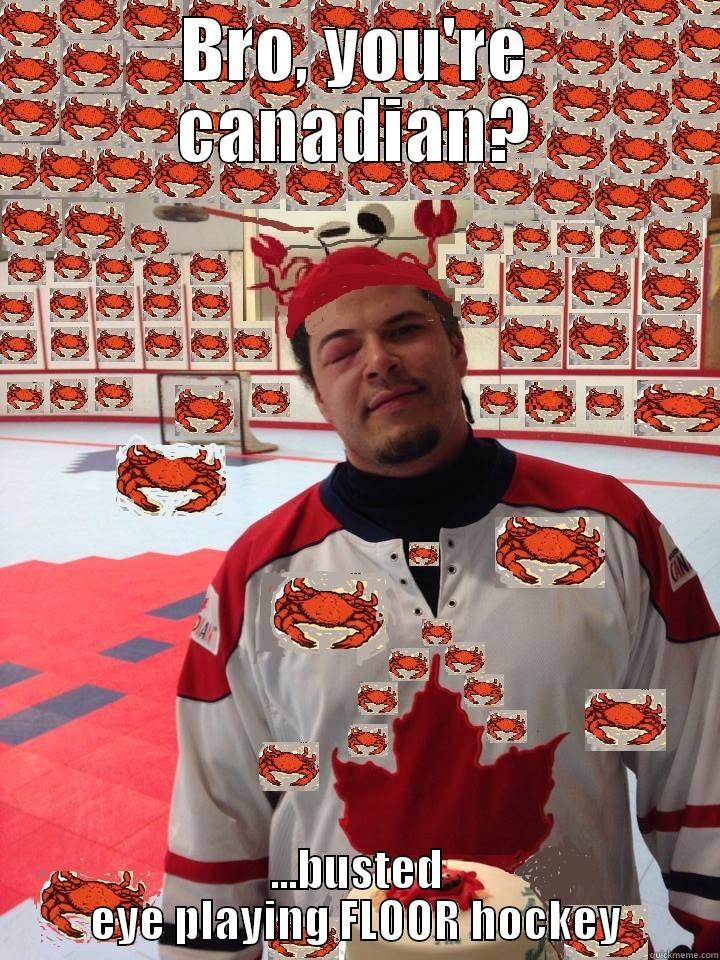 BRO, YOU'RE CANADIAN? ...BUSTED EYE PLAYING FLOOR HOCKEY Misc