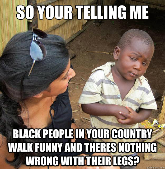So your telling me  black people in your country walk funny and theres nothing wrong with their legs?  
