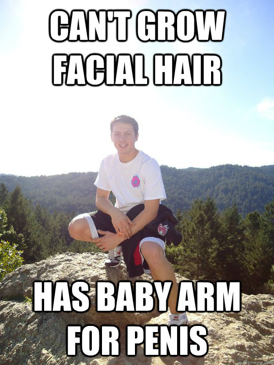 can't grow facial hair Has baby arm for penis - can't grow facial hair Has baby arm for penis  Unambitious Athlete