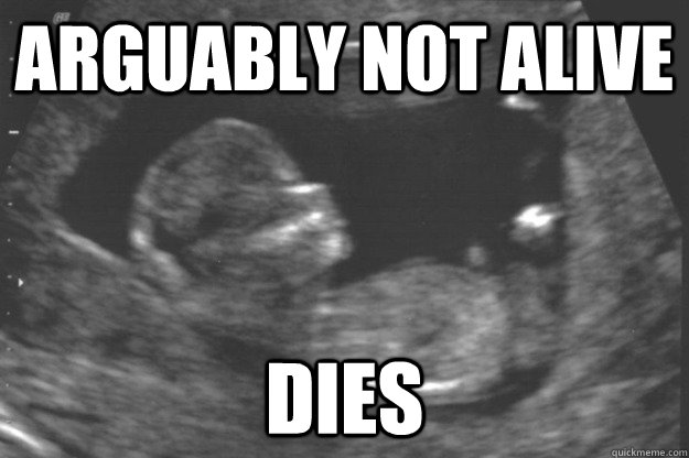 ARGUABLY NOT ALIVE DIES - ARGUABLY NOT ALIVE DIES  Prenatal Freshman