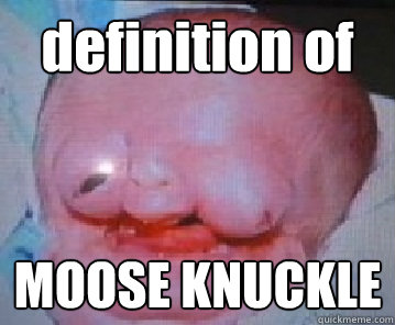 definition of MOOSE KNUCKLE - definition of MOOSE KNUCKLE  Xxxx
