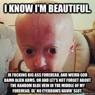 I know I'm beautiful. jk fucking big ass forehead, and weird god damn alien arms. Oh and let's not forget about the random blue vein in the middle of my forehead. Ol' no eyebrows havin' slut. - I know I'm beautiful. jk fucking big ass forehead, and weird god damn alien arms. Oh and let's not forget about the random blue vein in the middle of my forehead. Ol' no eyebrows havin' slut.  Misc