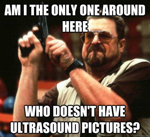 am I the only one around here Who doesn't have ultrasound pictures?  Angry Walter