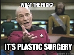 what the fuck? It's plastic surgery  Annoyed Picard