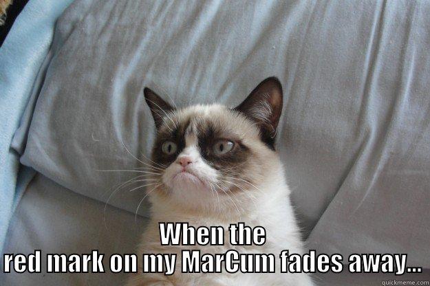 This is the face I make -  WHEN THE RED MARK ON MY MARCUM FADES AWAY... Grumpy Cat