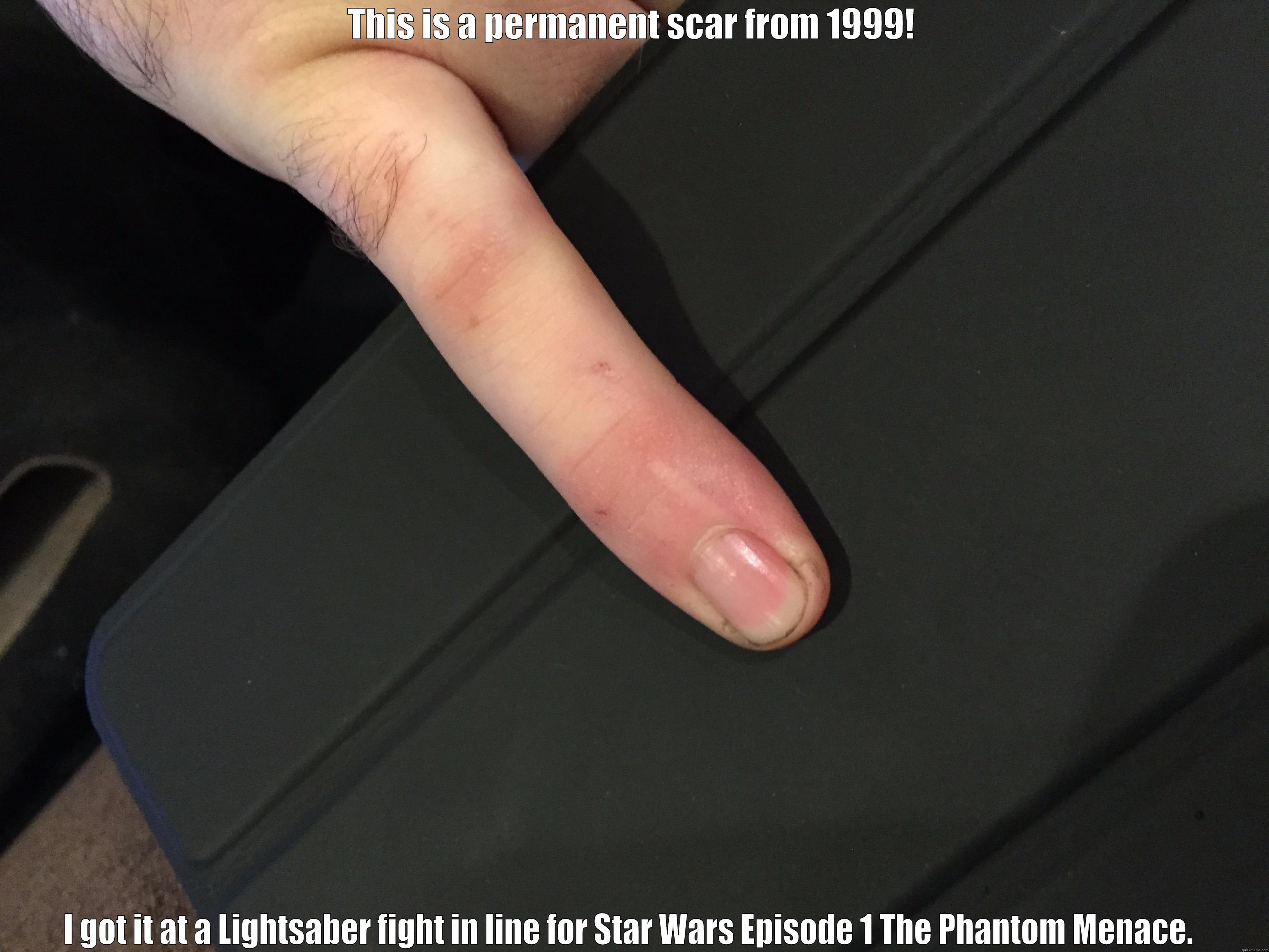 THIS IS A PERMANENT SCAR FROM 1999! I GOT IT AT A LIGHTSABER FIGHT IN LINE FOR STAR WARS EPISODE 1 THE PHANTOM MENACE.  Misc