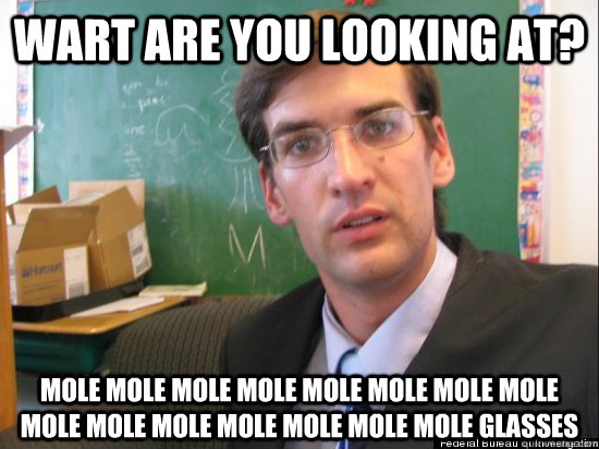 wart are you looking at? mole mole mole mole mole mole mole mole mole mole mole mole mole mole mole glasses  