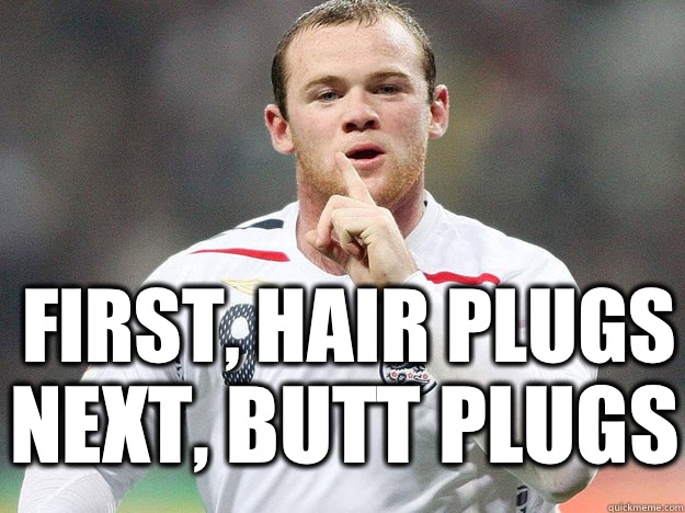 First, Hair Plugs Next, Butt Plugs   Wayne Rooney