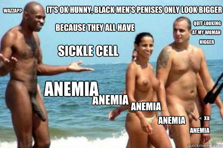it's ok hunny, black men's penises only look bigger  sickle cell anemia because they all have  anemia anemia anemia anemia quit looking  at my woman nigger wazzap? <   XD  huge black cock