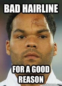 bad hairline for a good reason - bad hairline for a good reason  lescott