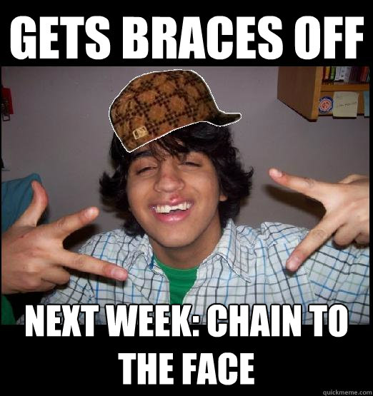 Gets Braces Off Next week: chain to the face - Gets Braces Off Next week: chain to the face  Scumbag J
