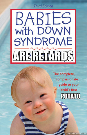 are retards potato  down syndrome