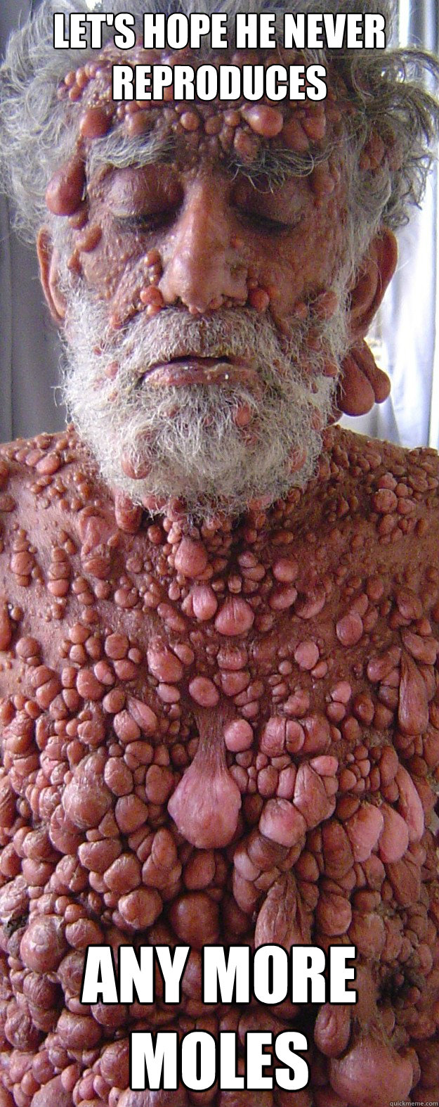 let's HOPE HE NEVER REPRODUCES ANY MORE MOLES - let's HOPE HE NEVER REPRODUCES ANY MORE MOLES  Overly moley guy